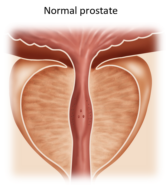 Illustration of normal prostate