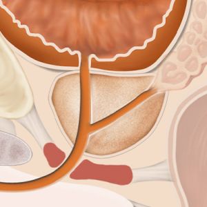 Medical illustration of the prostate gland located below the bladder in men.