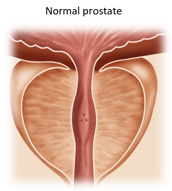Illustration of normal prostate