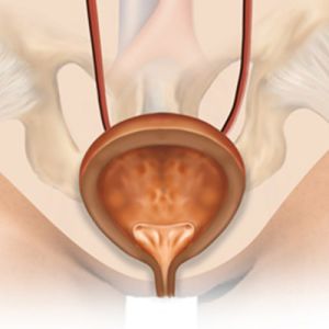 Illustration of the bladder and urinary tract showing bladder neck.